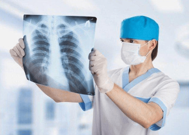 Chụp X-quang phổi để xác định tình trạng sức khỏe