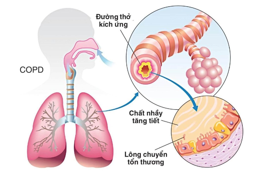 Hô hấp là gì Chức năng của hệ hô hấp đối với cơ thể